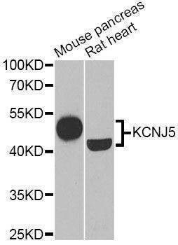 Anti-KCNJ5 Antibody
