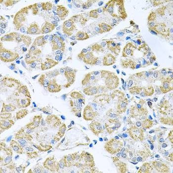Anti-TNFRSF10A Antibody