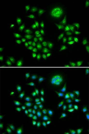 Anti-AGFG1 Antibody