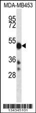Anti-CYP2D6 (N-term) Antibody