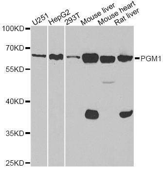 Anti-PGM1 Antibody