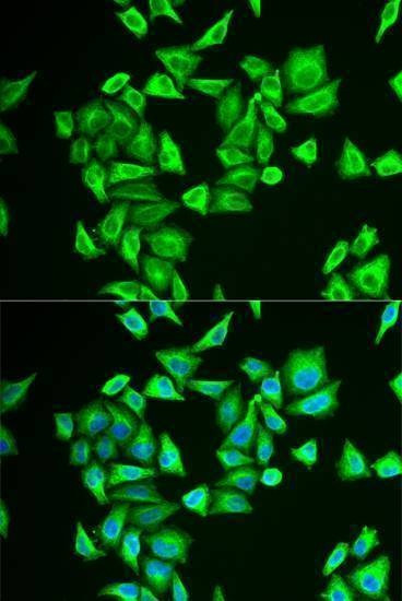 Anti-PGM1 Antibody