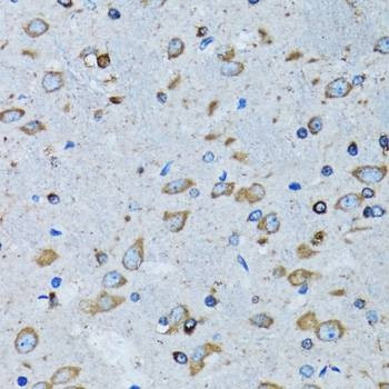 Anti-RARS Antibody