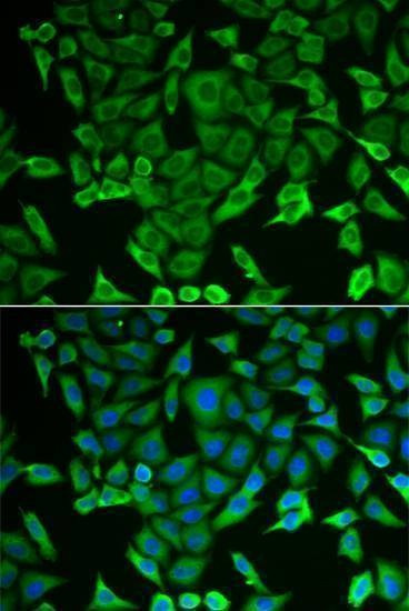 Anti-RARS Antibody