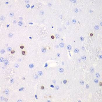 Anti-TKT Antibody