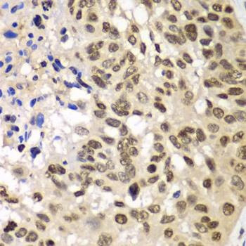 Anti-UBE2B Antibody