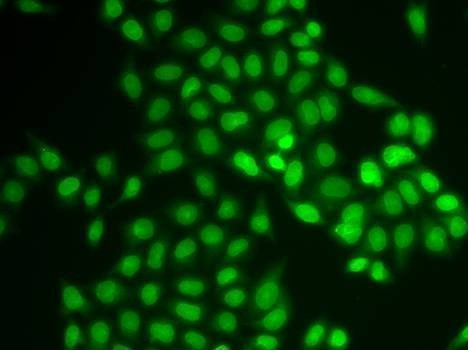 Anti-UBE2V1 Antibody