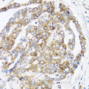 Anti-BCAP29 Antibody
