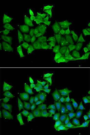 Anti-RHOH Antibody