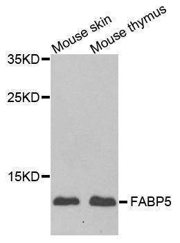 Anti-FABP5 Antibody