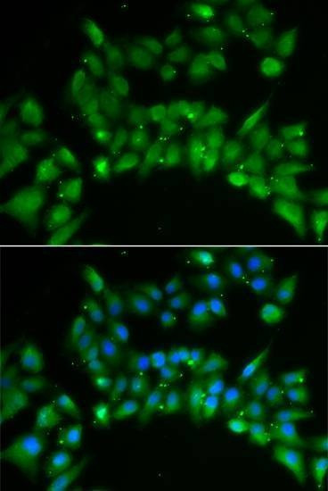 Anti-ISL1 Antibody
