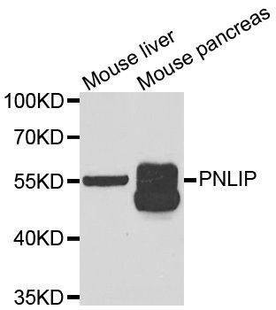 Anti-PNLIP Antibody