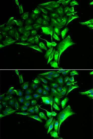 Anti-PYGB Antibody