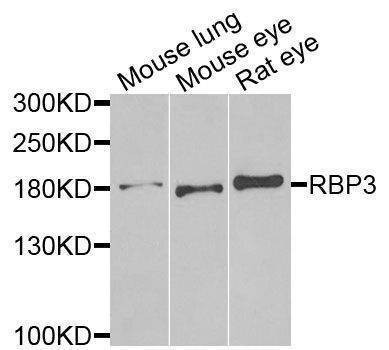 Anti-RBP3 Antibody