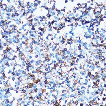 Anti-SPN Antibody