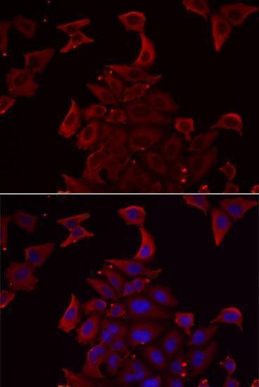 Anti-PDHX Antibody