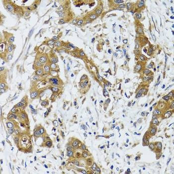 Anti-BLZF1 Antibody