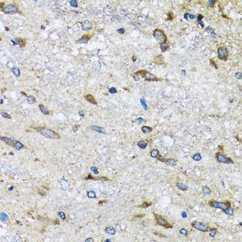 Anti-BLZF1 Antibody