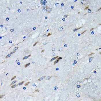 Anti-BLZF1 Antibody