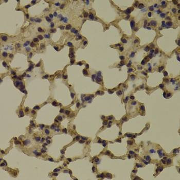 Anti-RNGTT Antibody