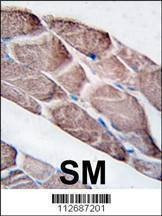 Anti-EPM2A (C-term) Antibody
