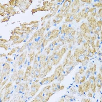 Anti-IL18BP Antibody