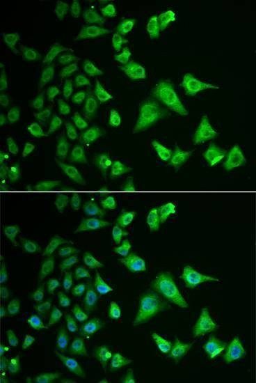 Anti-DHRS2 Antibody