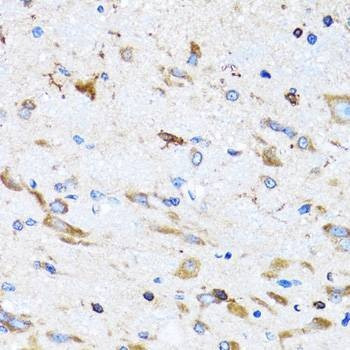 Anti-PTRH2 Antibody