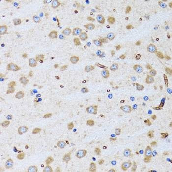 Anti-PTRH2 Antibody