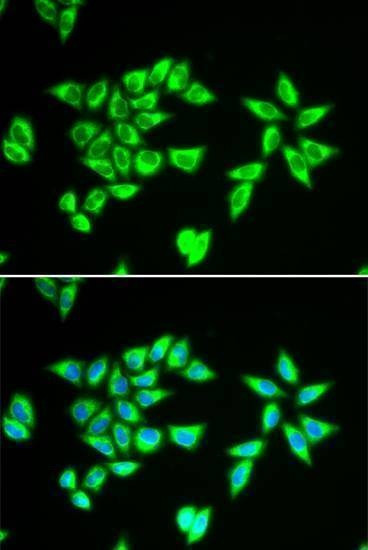 Anti-PTRH2 Antibody