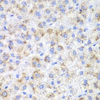 Anti-HAO1 Antibody