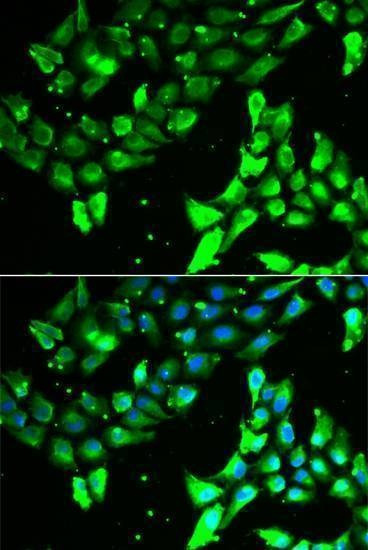 Anti-KIF2B Antibody