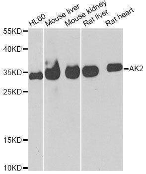 Anti-AK2 Antibody