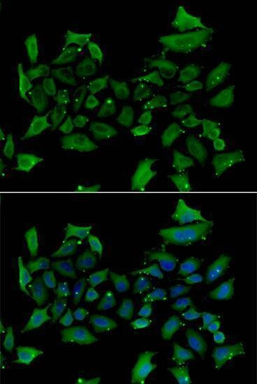 Anti-ALAS1 Antibody