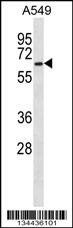 Anti-PRPF31 (C-term) Antibody