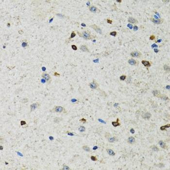 Anti-BHLHE40 Antibody