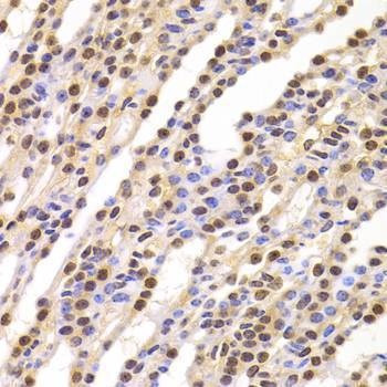 Anti-BUB3 Antibody