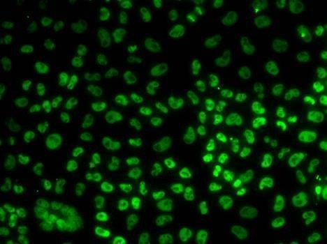Anti-BUB3 Antibody