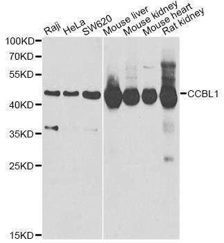 Anti-CCBL1 Antibody