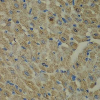 Anti-CCBL1 Antibody