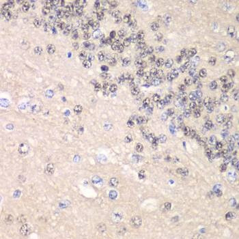 Anti-CCNC Antibody