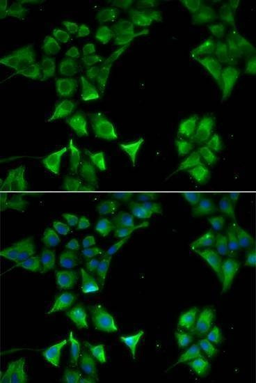 Anti-CD177 Antibody