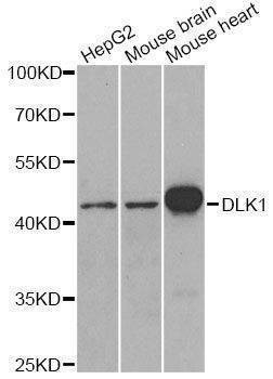 Anti-DLK1 Antibody