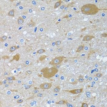 Anti-EIF2S3 Antibody