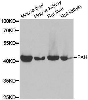 Anti-FAH Antibody