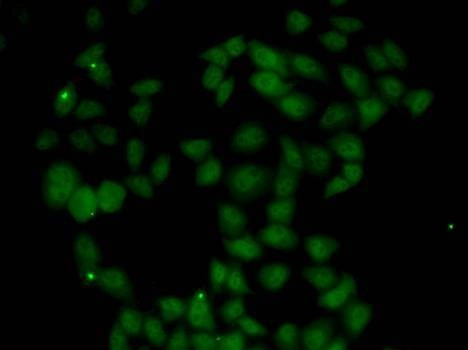 Anti-FGF14 Antibody