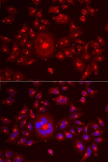 Anti-GORASP1 Antibody