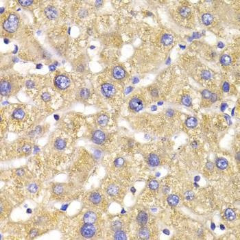 Anti-GPD2 Antibody