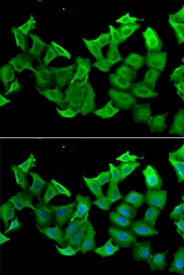 Anti-HAGH Antibody