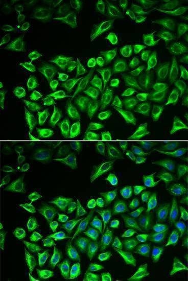 Anti-HAS3 Antibody